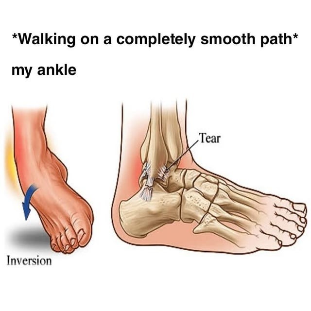 Sprained ankle - meme