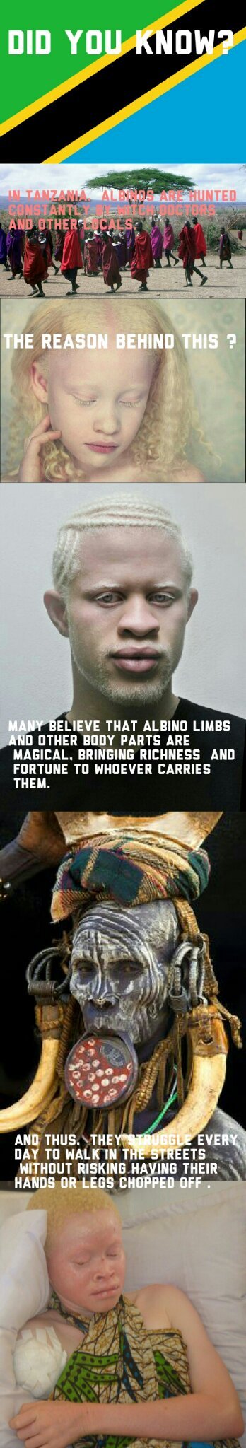 Bad luck albinos - meme