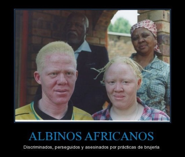 Albinos africanos - meme