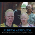 Albinos africanos