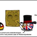 poland syndrome