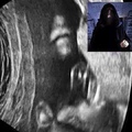 the dark side of the womb