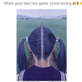 Straight hairline