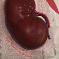 Kidney cake for anniversary for donating a kidney
