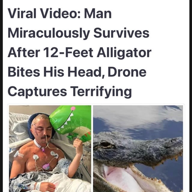 Man survives alligator bites his head - meme