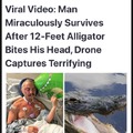 Man survives alligator bites his head