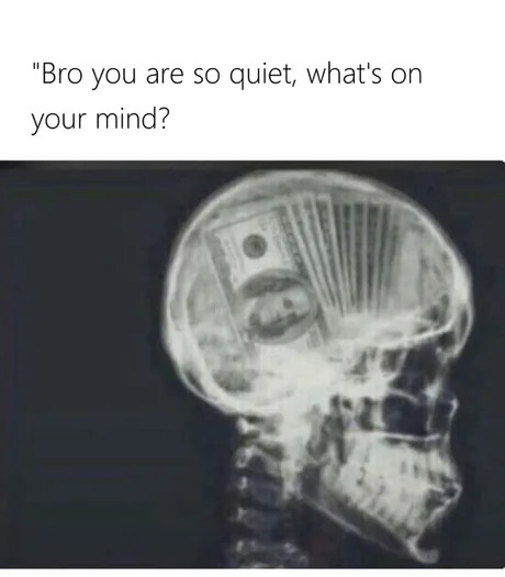Brain stonks - meme