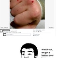 commented item thumbnail
