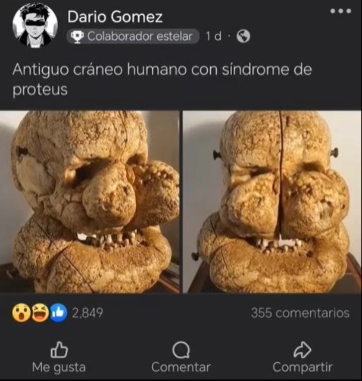 El tumor del 87 - meme