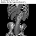 Prostate exam meme
