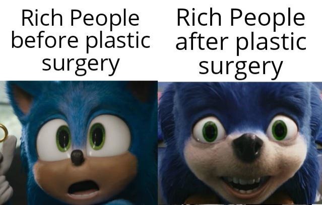 people after plastic surgery - meme