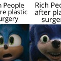 people after plastic surgery