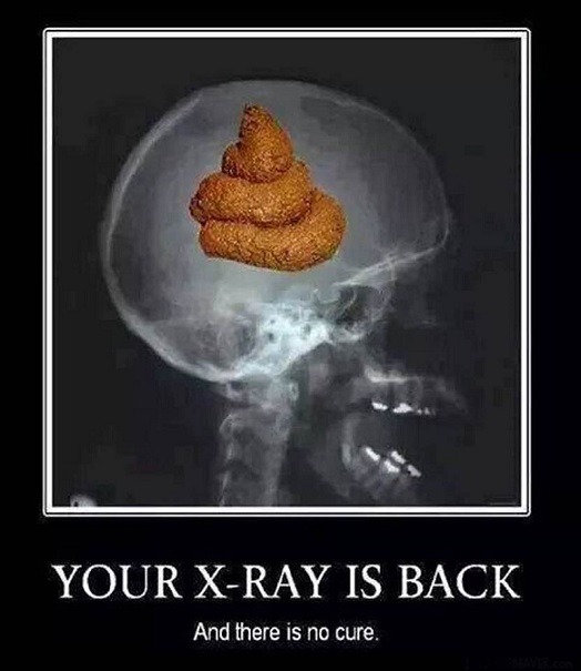 Your x-ray is back - meme