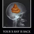 Your x-ray is back