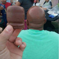 Candy look like this dudes head