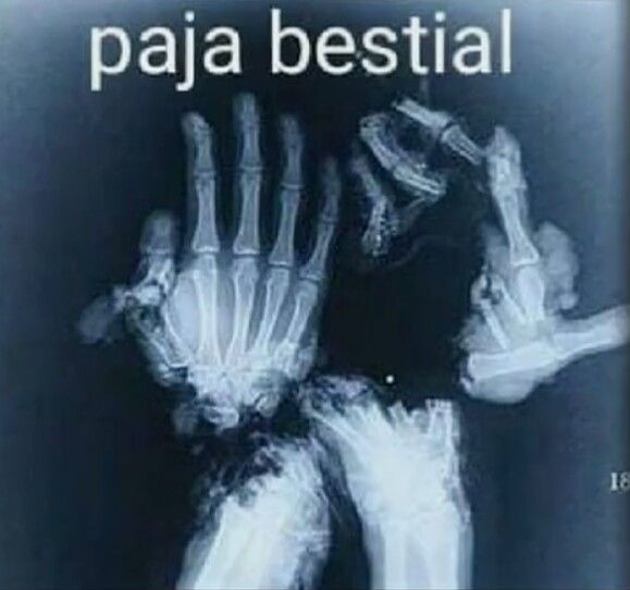 ostias - meme
