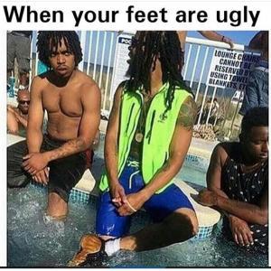 Dont wear flip flop when you have nasty toes. Just walk with bare feet - meme