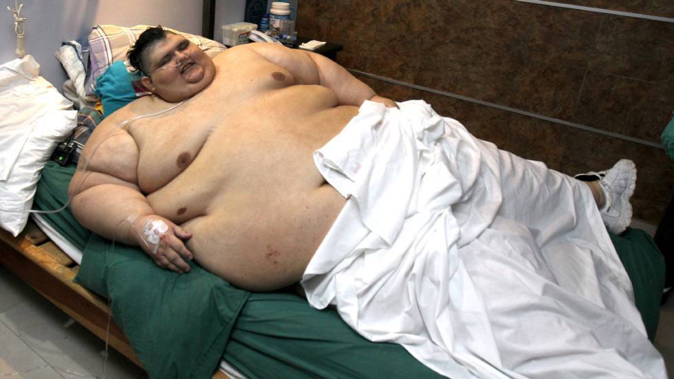 Persona mas obesa del mundo