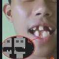 commented item thumbnail