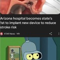 Arizona hospoital beomes state's 1st to implant new device to reduce stroke risk