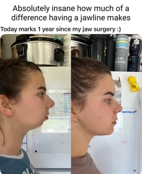 The best Jawline memes :) Memedroid