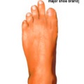 The human foot