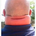 commented item thumbnail