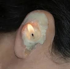 Ear wax candle - meme
