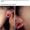Fuckin ear