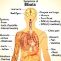 Here is how to know if you or someone you know has Ebola. Be safe guys!