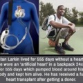 Man with bionic heart