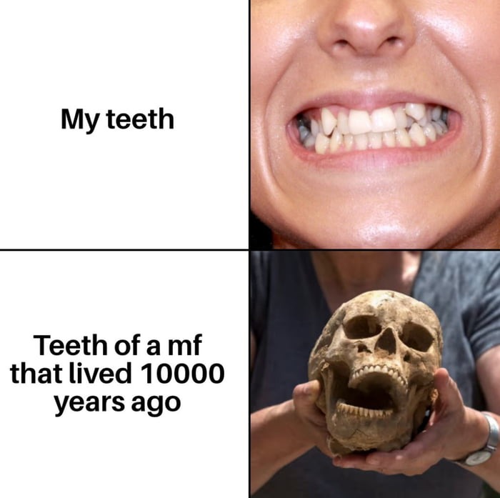 Caveman orthodontists obviously - meme