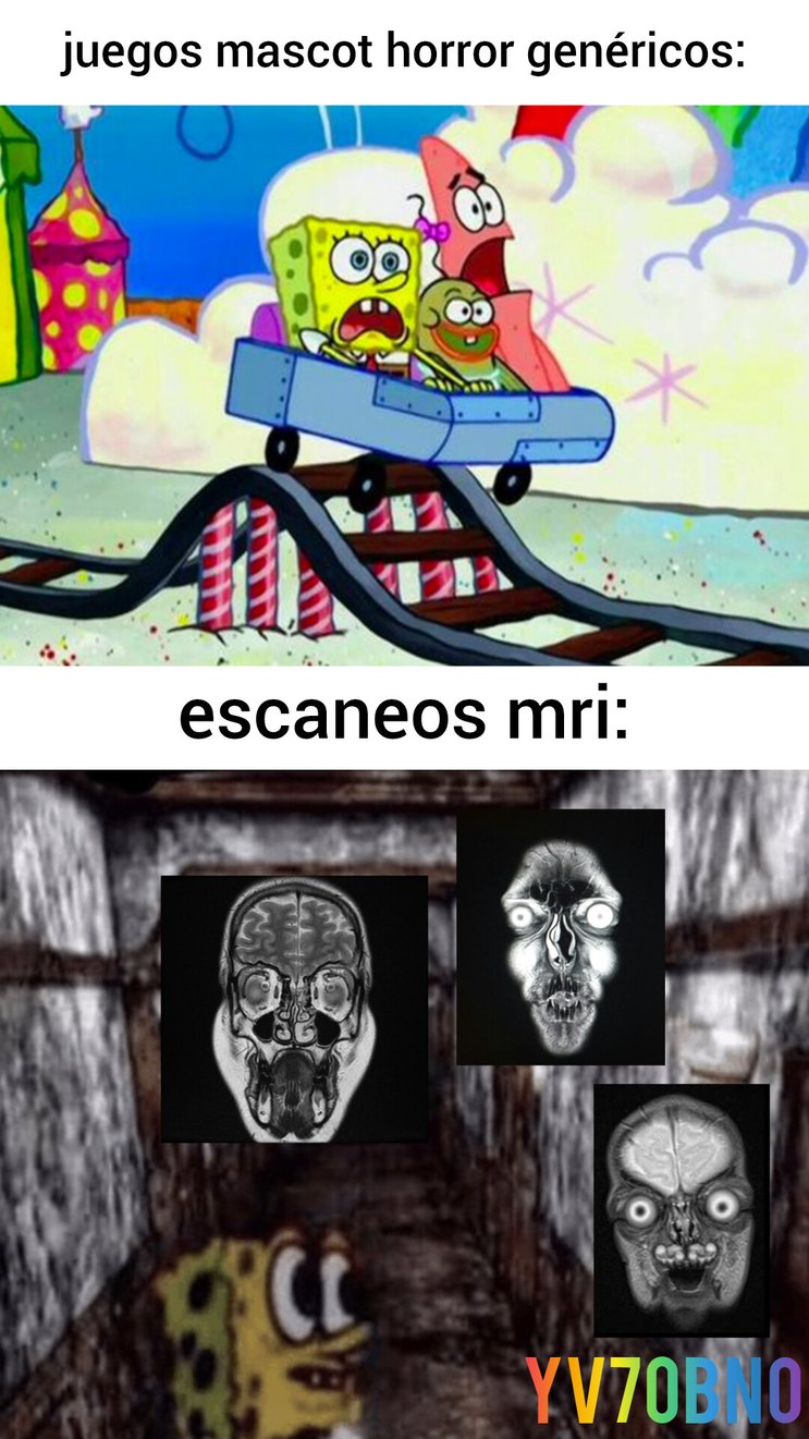 Escaneos mri - meme