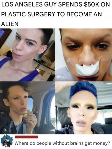 Plastic surgery to become an alien - meme