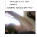 arm knee