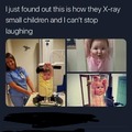 X-raying small children…