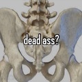 Dead ass? :trollface