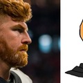 Andy Dalton is Ginger Chad