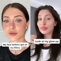 commented item thumbnail