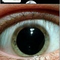 O que faz sua pupila dilata?