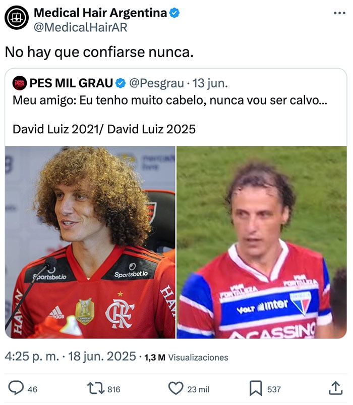 Mi bro diciendo que nunca será calvo // David Luiz: sorpresa - meme