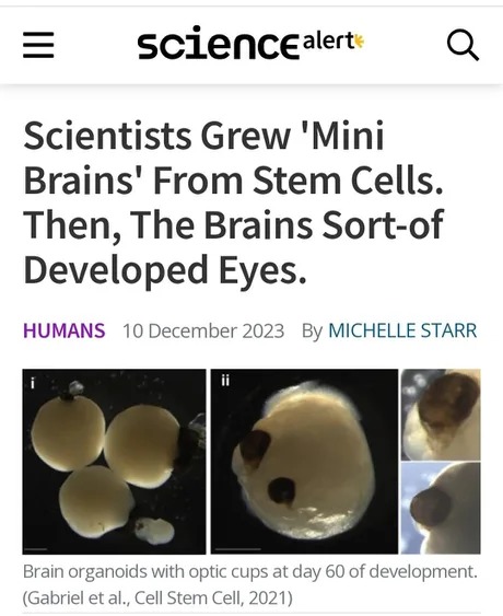 Scientists grew Mini Brains from Stem cells - meme