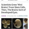 Scientists grew Mini Brains from Stem cells