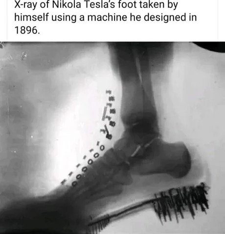 Nikola Tesla X-Ray - meme