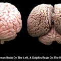Brain's