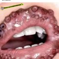 commented item thumbnail