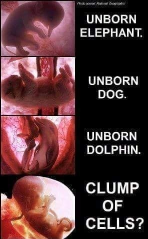 Abortion is murder, period - meme