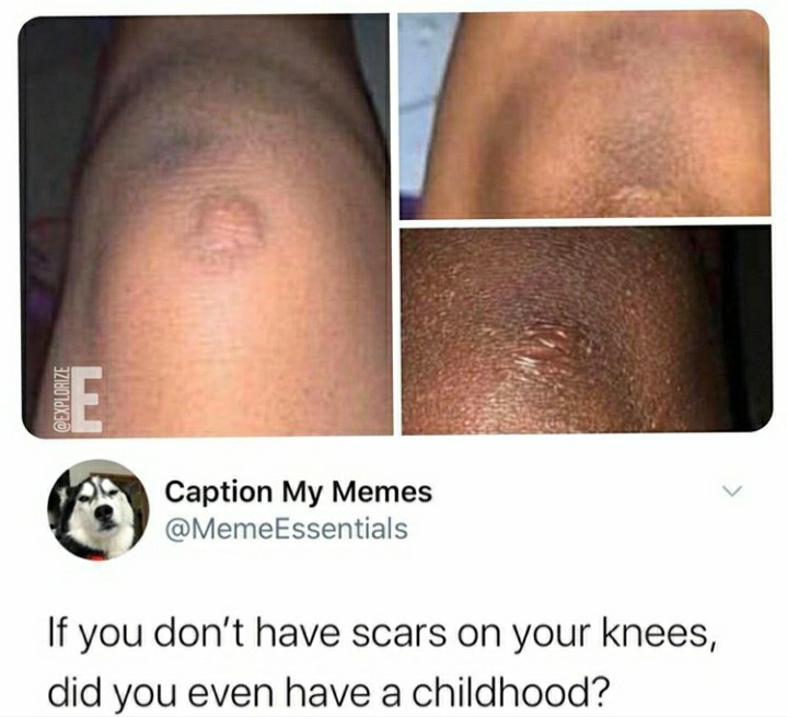 Some shit knee relatability - meme