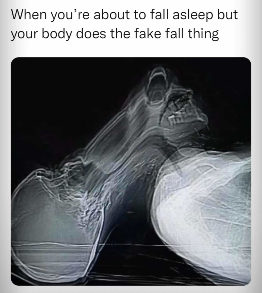 What is this xray tho - meme