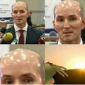 shining bald